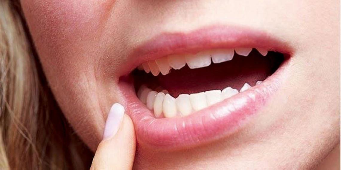 I denti del giudizio