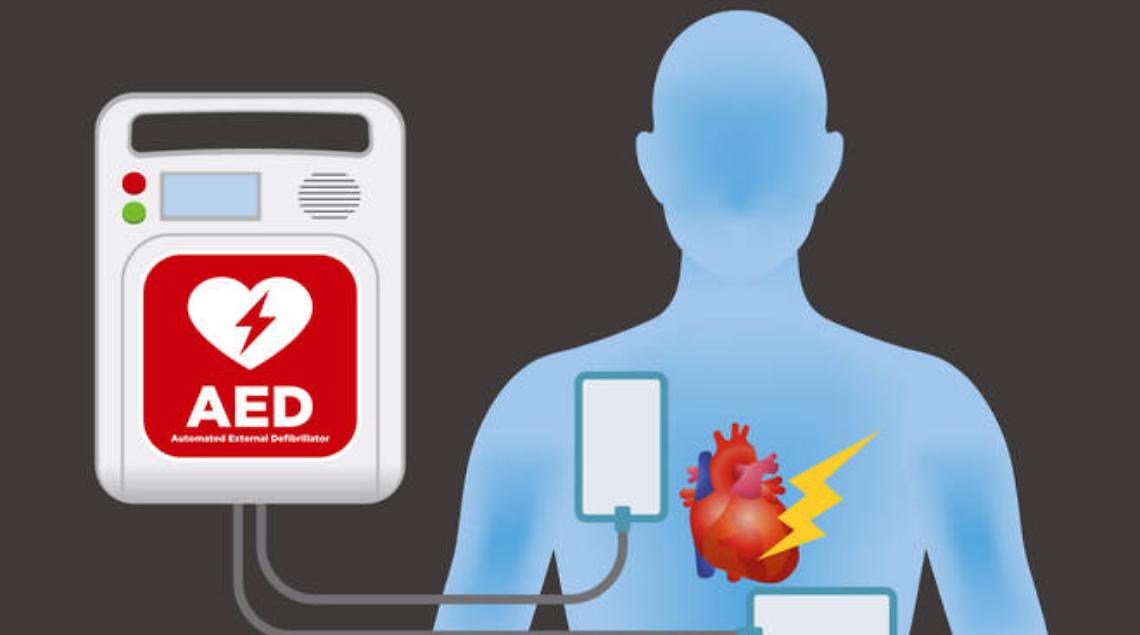 Un defibrillatore - archivio