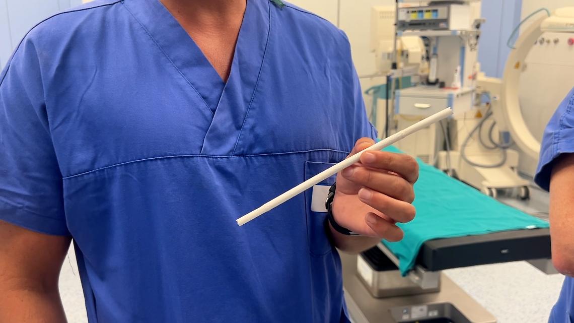La protesi sintetica di ultima generazione utilizzata al Policlinico di Bari