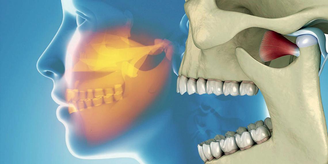 Il botulino e l’acido ialuronico come rimedi per il dolore facciale