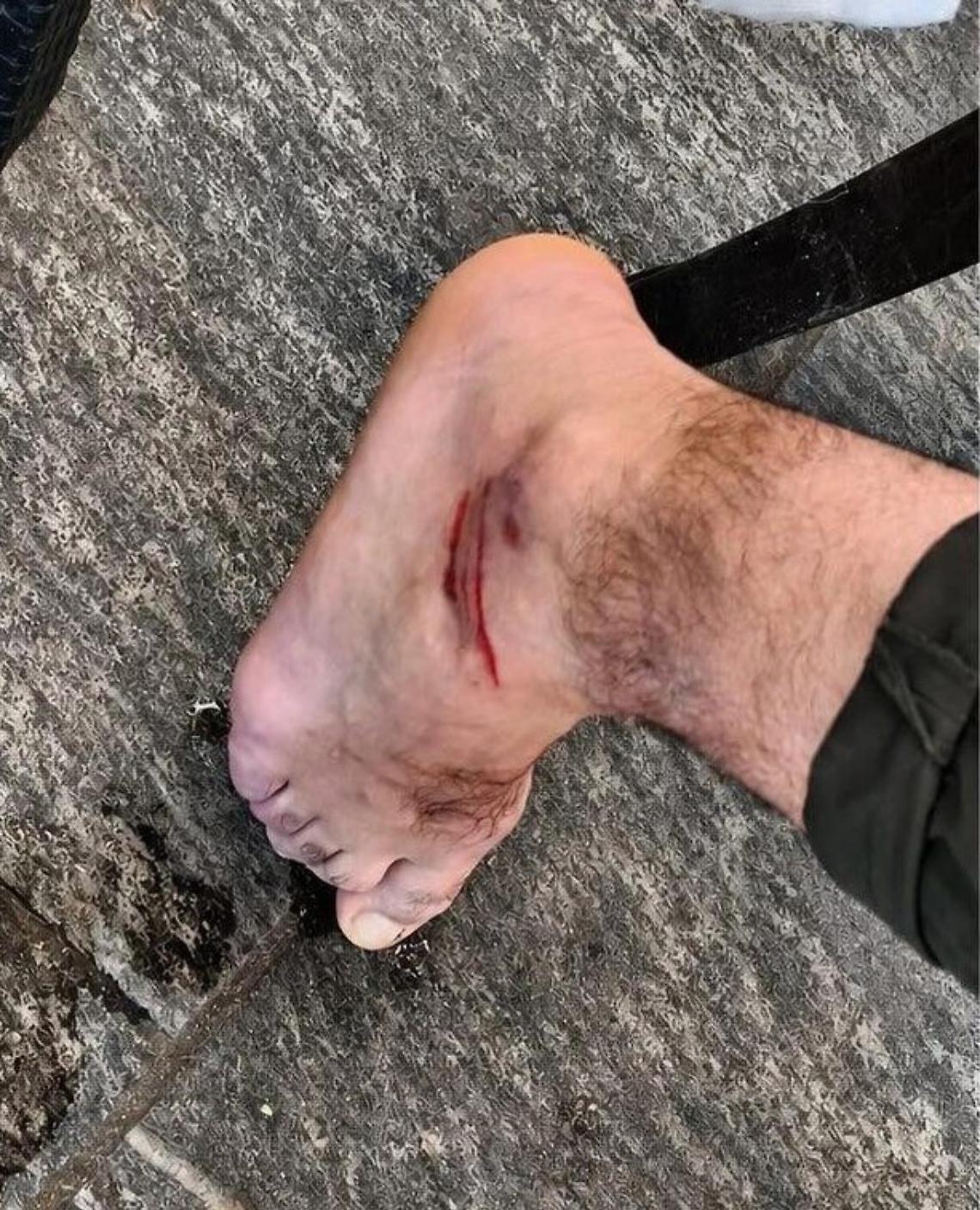 L&rsquo;assessore regionale Raffaele Piemontese investito da un monopattino