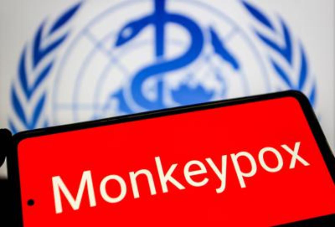 Vaiolo scimmie: Oms, scoperto in 2 pazienti virus mix di 2 cladi Mpox