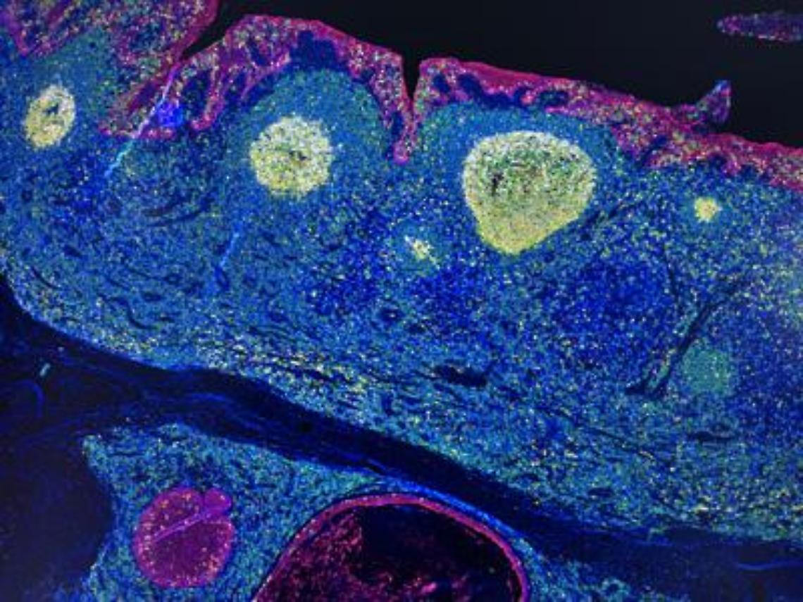 Irccs Pascale Napoli, 'mappa Gps' delle cellule rivoluziona l'immunoterapia