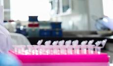 Staminali contro il Parkinson, in Giappone via libera al primo trattamento