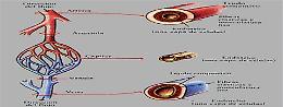 Arteriopatie degli arti inferiori, diagnosi e terapia