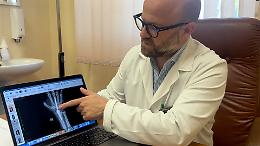 Protesi del polso: primo impianto nel sud Italia al Policlinico di Bari