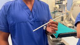 Al Policlinico di Bari si sperimenta una protesi riassorbibile per l'accesso vascolare nei pazienti dializzati