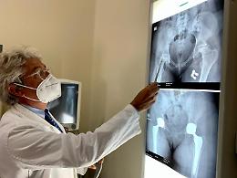 Il Policlinico di Bari prima struttura pubblica in Puglia per numero di protesi di anca e ginocchio