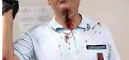 Agente di polizia penitenziaria aggredito nel carcere di Taranto