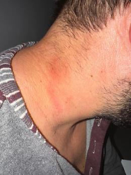 Violenza nel carcere di Trani: agente aggredito da un detenuto, prognosi di 15 giorni