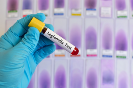 Piano anti-Legionella della Asl Bari: coinvolte oltre 1.400 strutture tra Rsa, alberghi e B&B