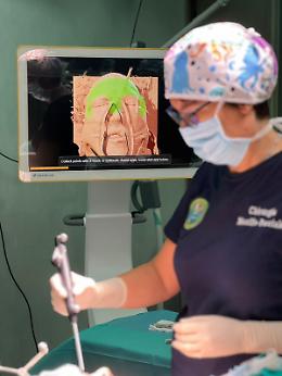 Tecnologia 3D in sala operatoria per ricostruire il volto dopo un trauma