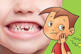 La traumatologia dentale nell'infanzia e nell'adolescenza