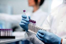 Hiv, test rapidi nei laboratori