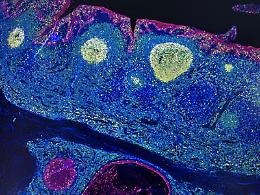 Irccs Pascale Napoli, 'mappa Gps' delle cellule rivoluziona l'immunoterapia