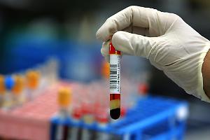 Laboratori di analisi, "Con la riforma diagnosi meno tempestive e liste d'attesa più lunghe"