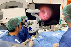 Policlinico, oltre 4.200 interventi di oculistica in sei mesi per recuperare le liste d'attesa