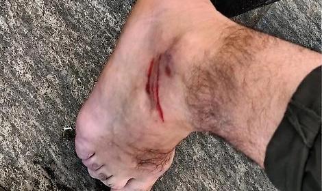 L&rsquo;assessore regionale Raffaele Piemontese investito da un monopattino